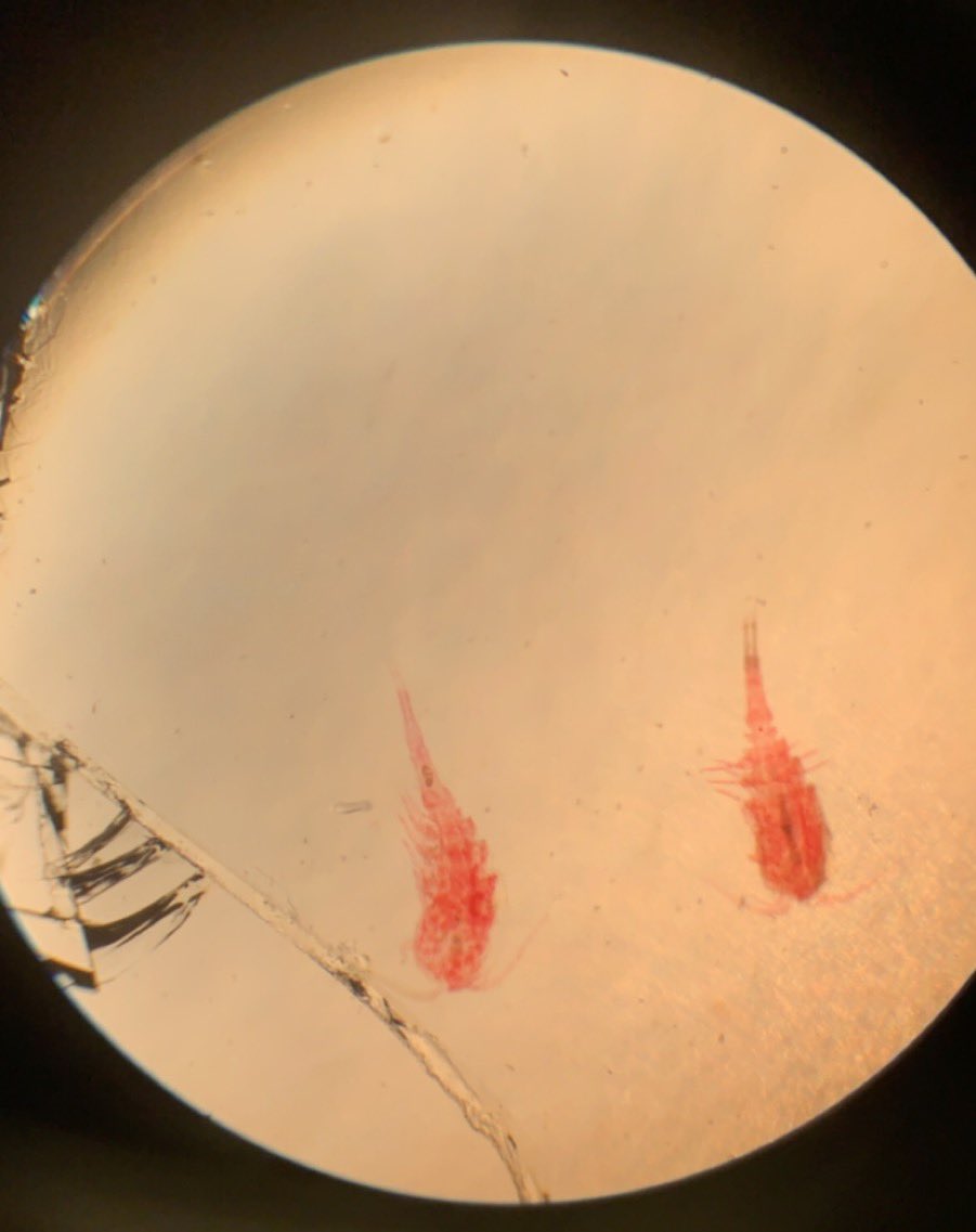 abbyprince11's tweet image. “when life gets blurry... adjust your focus” 

#microscopelab 
@MMCBiology