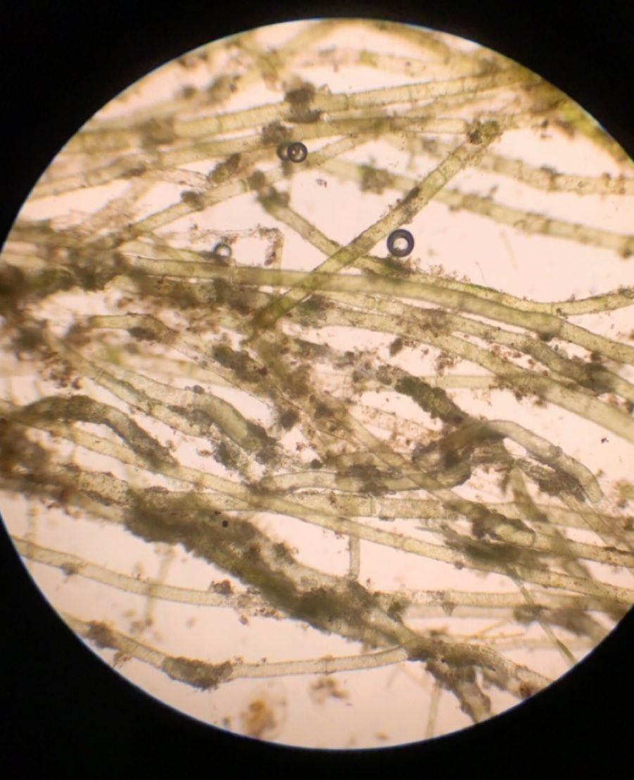 abbyprince11's tweet image. “when life gets blurry... adjust your focus” 

#microscopelab 
@MMCBiology