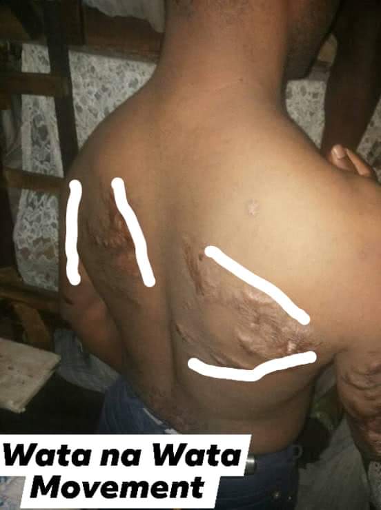 Dictator Paul Biya military use Pressing iron to torture Southern Cameroon, Ambazonian in prison.
Take a look at the picture below👇 <a href="/USUN/">U.S. Mission to the UN</a> <a href="/GermanyUN/">Germany in the United Nations</a> <a href="/RussiaUN/">Russia at the United Nations</a> <a href="/BelgiumUN/">Belgium UN New York</a> <a href="/UKUN_NewYork/">UK at the UN 🇬🇧🇺🇳</a> <a href="/realDonaldTrump/">Donald J. Trump</a> <a href="/Europarl_EN/">European Parliament</a> <a href="/EU_Commission/">European Commission</a> <a href="/BorisJohnson/">Boris Johnson</a> <a href="/KerryMP/">Kerry McCarthy</a> <a href="/AnnaMcMorrin/">Anna McMorrin MP</a> <a href="/cnni/">CNN International</a> <a href="/ABC/">ABC News</a>