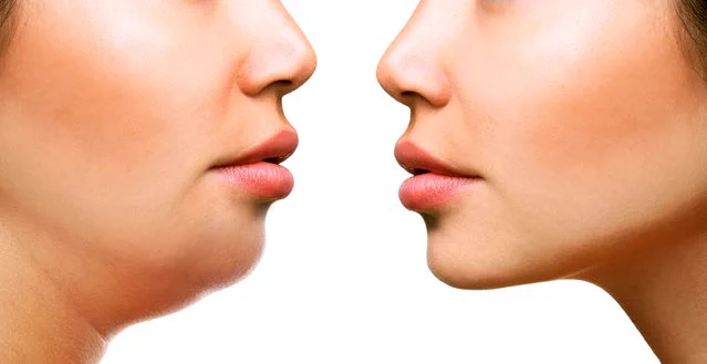 シュッとして綺麗な横顔になりたい！？そんな人にオススメなエクササイズがこれ！