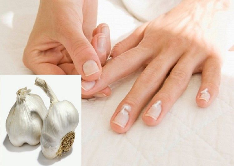 Grow the nails of your dreams with these tips | Times of India