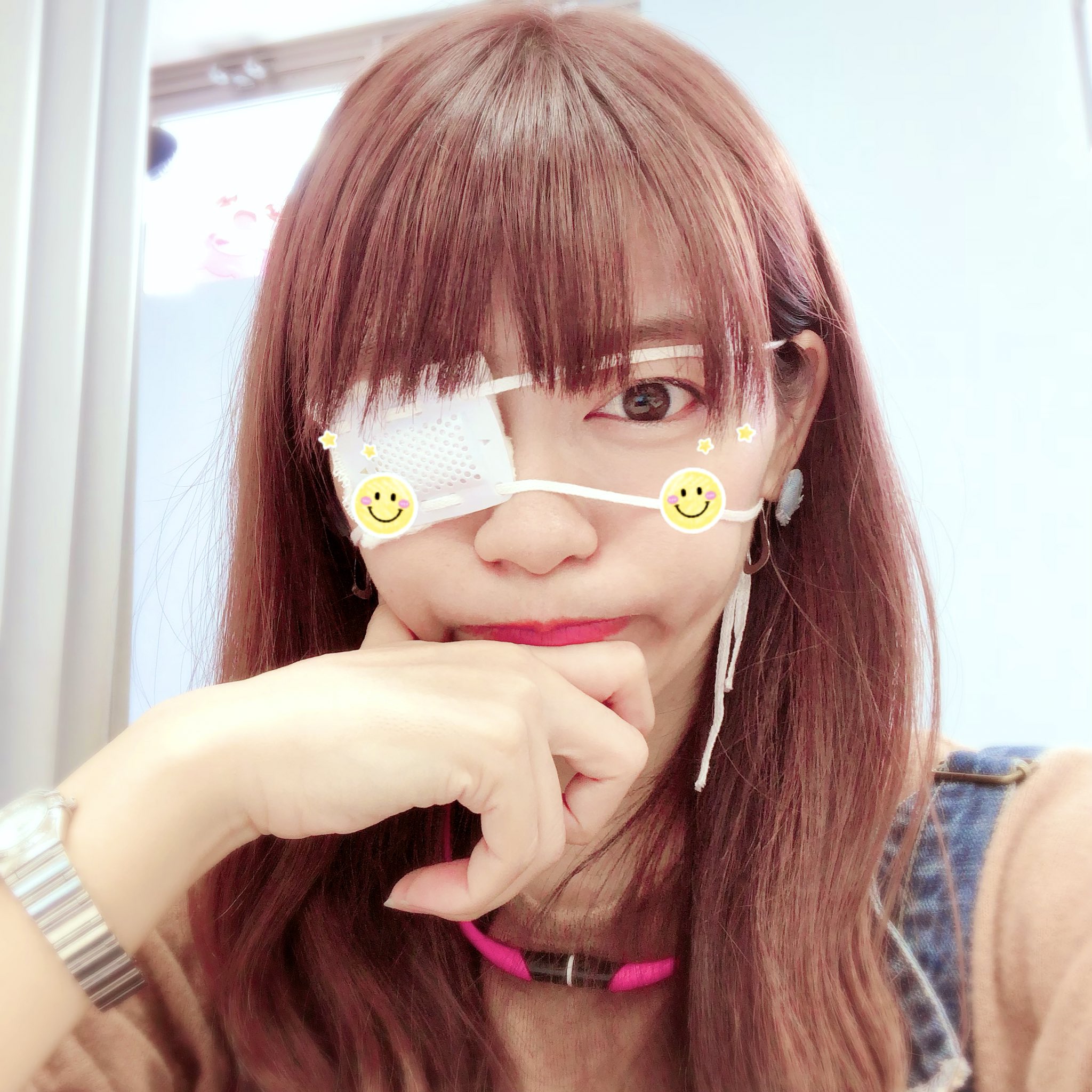 徳永なお 今日も眼帯生活 و ほとんど治ったんだけど まだ不安だからコンタクトはつけずに生活 片目だと位置感覚が難しい 健康って本当に素晴らしいことなんだなって実感する T Co Zlcpu2wycs Twitter