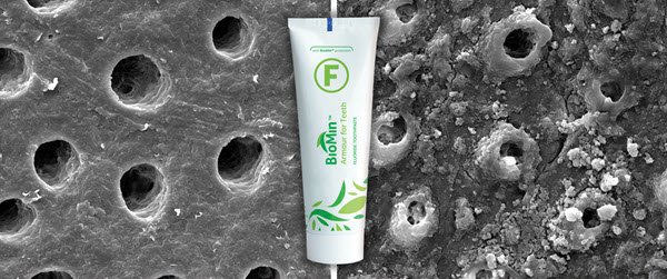 upbeatcare's tweet photo. Conventional toothpastes deliver fluoride for a max of just 90 mins after brushing.
#BioMinF protects with fluoride for up to 12 hours - that's EIGHT times longer! Find out more > https://t.co/1SSJiJELkD https://t.co/QKezsUnmdQ