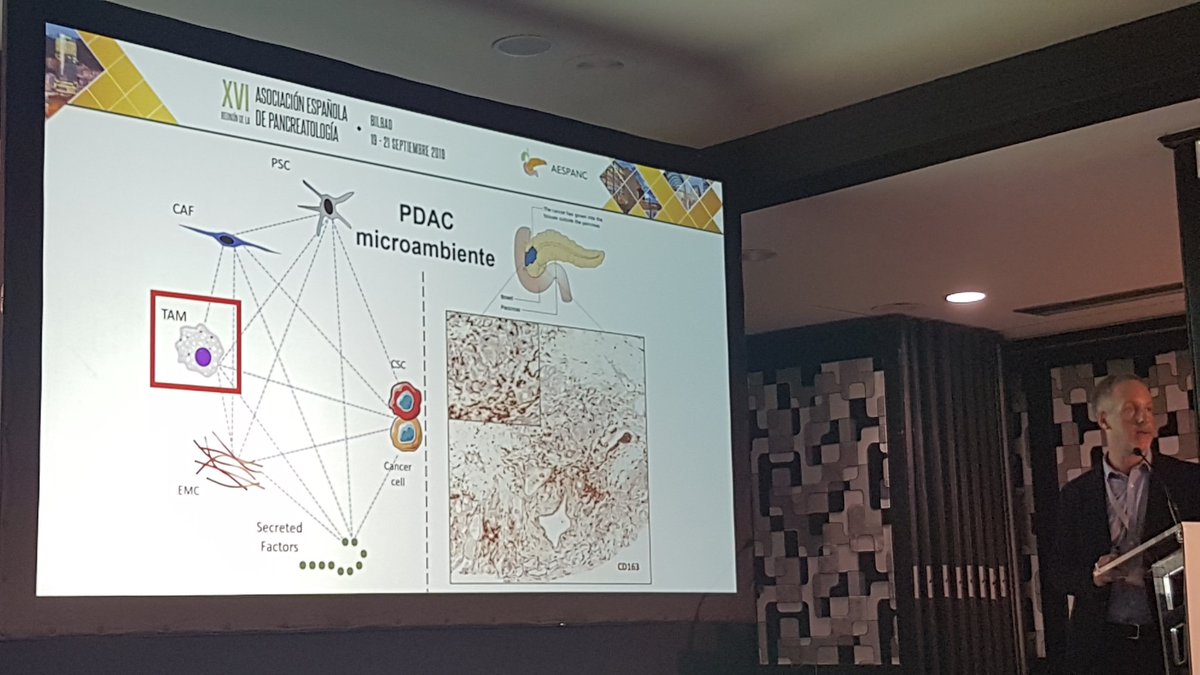 AESPANC's tweet image. Nuevas líneas de investigación en Ca Páncreas: Genómica, nueva medicación, células madre, microambiente, medicina personalizada e inmunoterapia.. Interesante revisión dada por Bruno Sainz