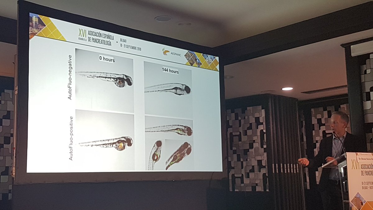 AESPANC's tweet image. Nuevas líneas de investigación en Ca Páncreas: Genómica, nueva medicación, células madre, microambiente, medicina personalizada e inmunoterapia.. Interesante revisión dada por Bruno Sainz
