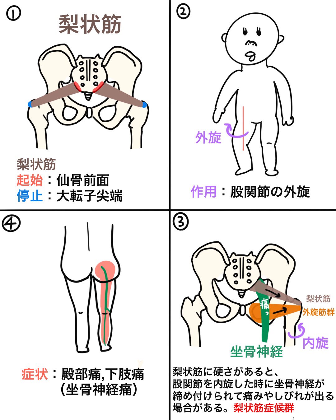 ゴロ 解剖生理イラスト ٹوئٹر پر ４コマで分かる 坐骨神経痛 梨状筋症候群編