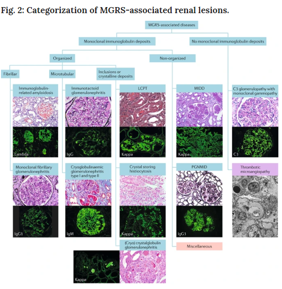 NatRevNeph's tweet photo. Categorization of MGRS-associated renal lesions: 
a consensus report of the International Kidney and Monoclonal Gammopathy Research Group https://t.co/MI5qMeXdin https://t.co/glrgUsE0nD