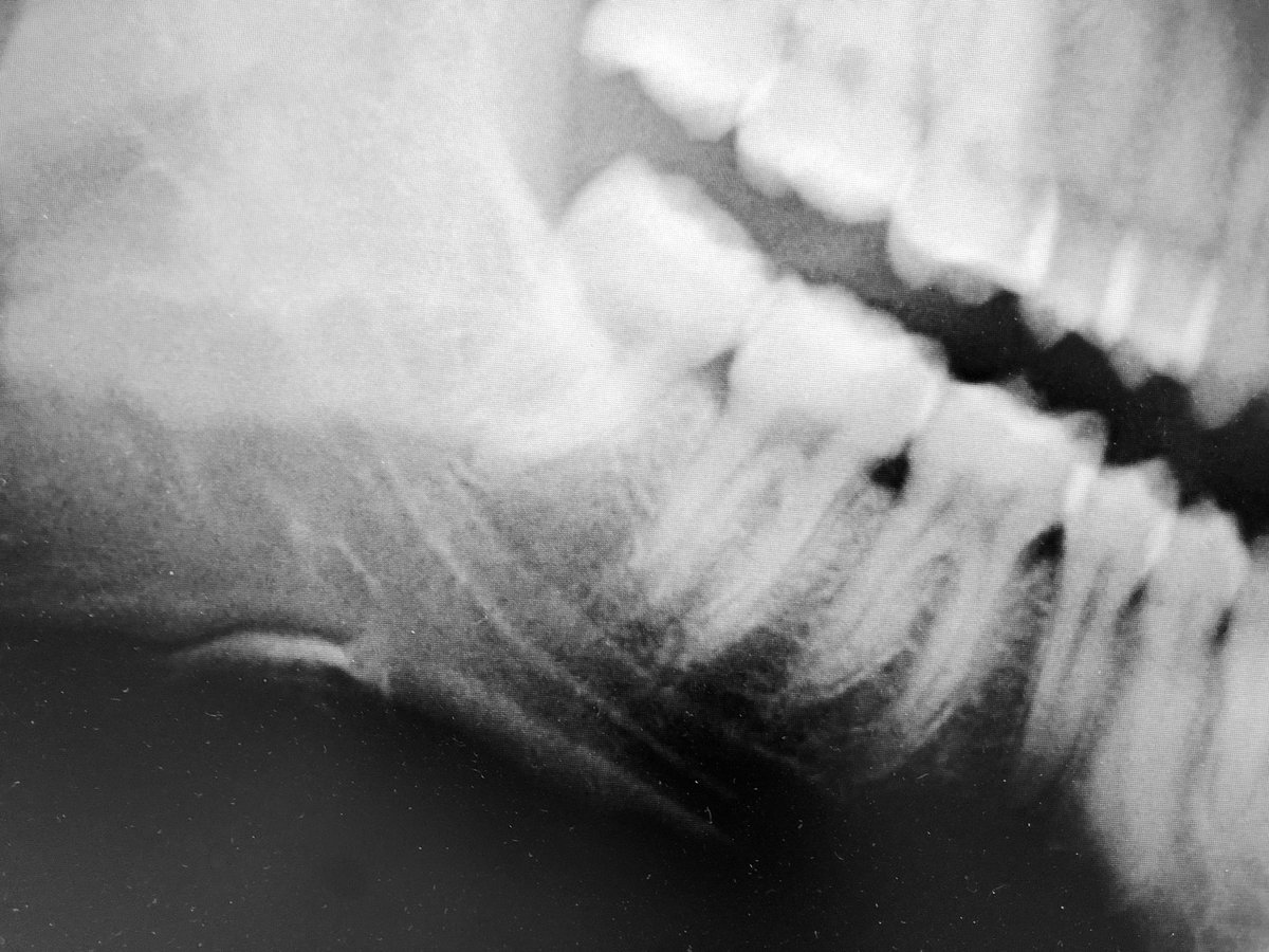 theAFOHR's tweet photo. #AFOHR #FOSGs. 
GOAL 7 
Quality #AgeDetermination = provide dental definitive #ageassessment &amp; adulthood determination method using #teeth 

OBJETIVO 7
Determinación edad = proporcionar evaluación dental definitiva edad y un método de determinación edad adulta con dientes. https://t.co/uA7kOhH9P8