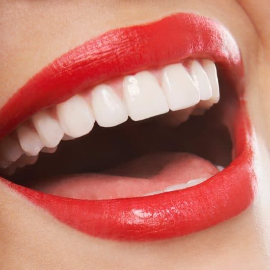 Visit our Instagram and website for more
#Bury #Buryhour #Dentist #compositebonding #invisalign #compositeveneers #whiteteeth
dentistinbury.co.uk