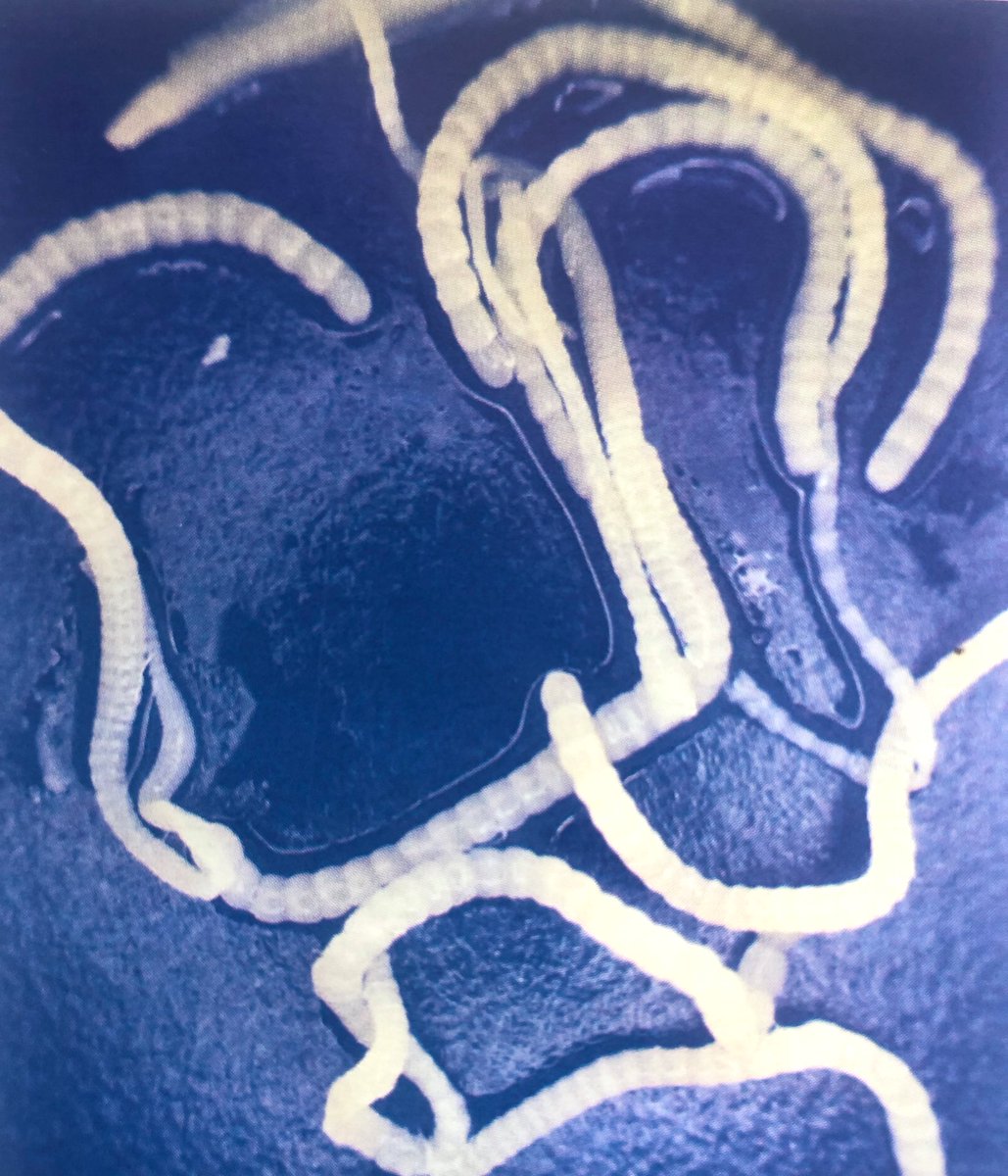 Avivets on Twitter tapeworm in chickens, Raillietina