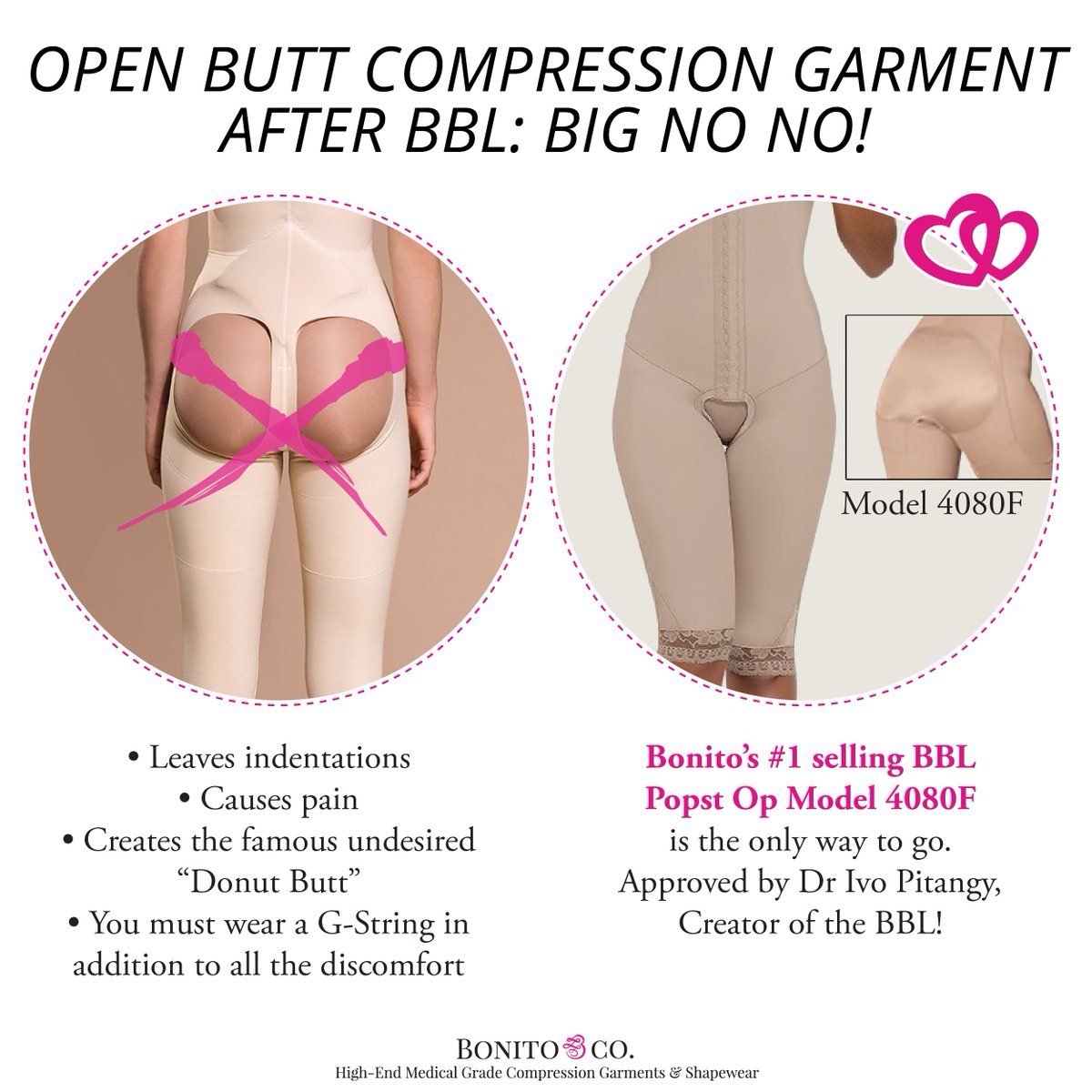 Bonito & Co. on X: Open butt Compression Garment after BBL. Big no no!  #compressiongarments #compressiongarment #bestcompressiongarments #fajas  #faja #medicalgradecompression #postop #postopcare #plasticsurgery  #compressionbra #BBL
