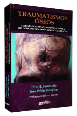 epafperu's tweet photo. A la venta “Traumatismos Oseos: Lesiones ocasionadas por violaciones a los derechos humanos y conflicto armado” de José Pablo Baraybar y Erin H. Kimmerle, una herramienta básica y primordial para el trabajo forense y la investigación médico-legal. Pedidos epafperu@epafperu.org https://t.co/KHGPXymNs1