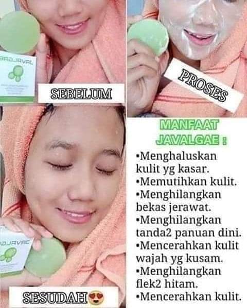 🌷Javal Gae NASA🌷

produk terbaru Dari Nasa😍
manfaat: 
💚 membantu menghaluskan kulit kasar
💚 membantu memutihkan kulit
💚 membantu menghilangkan bekas jerawat
💚 membanru menghilangkan tanda2 penuaan dini
💚 membantu mencerahkan kulit wajah yg kusam
