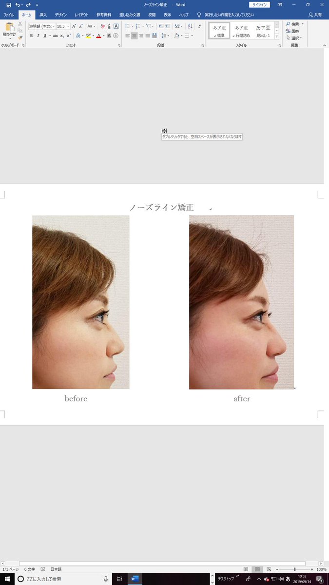 Prana 鼻 小顔矯正に特化 トータル骨格美容矯正サロン Prana Twitter Prana 鼻 小顔矯正に特化 トータル骨格美容矯正サロン Prana Twitter