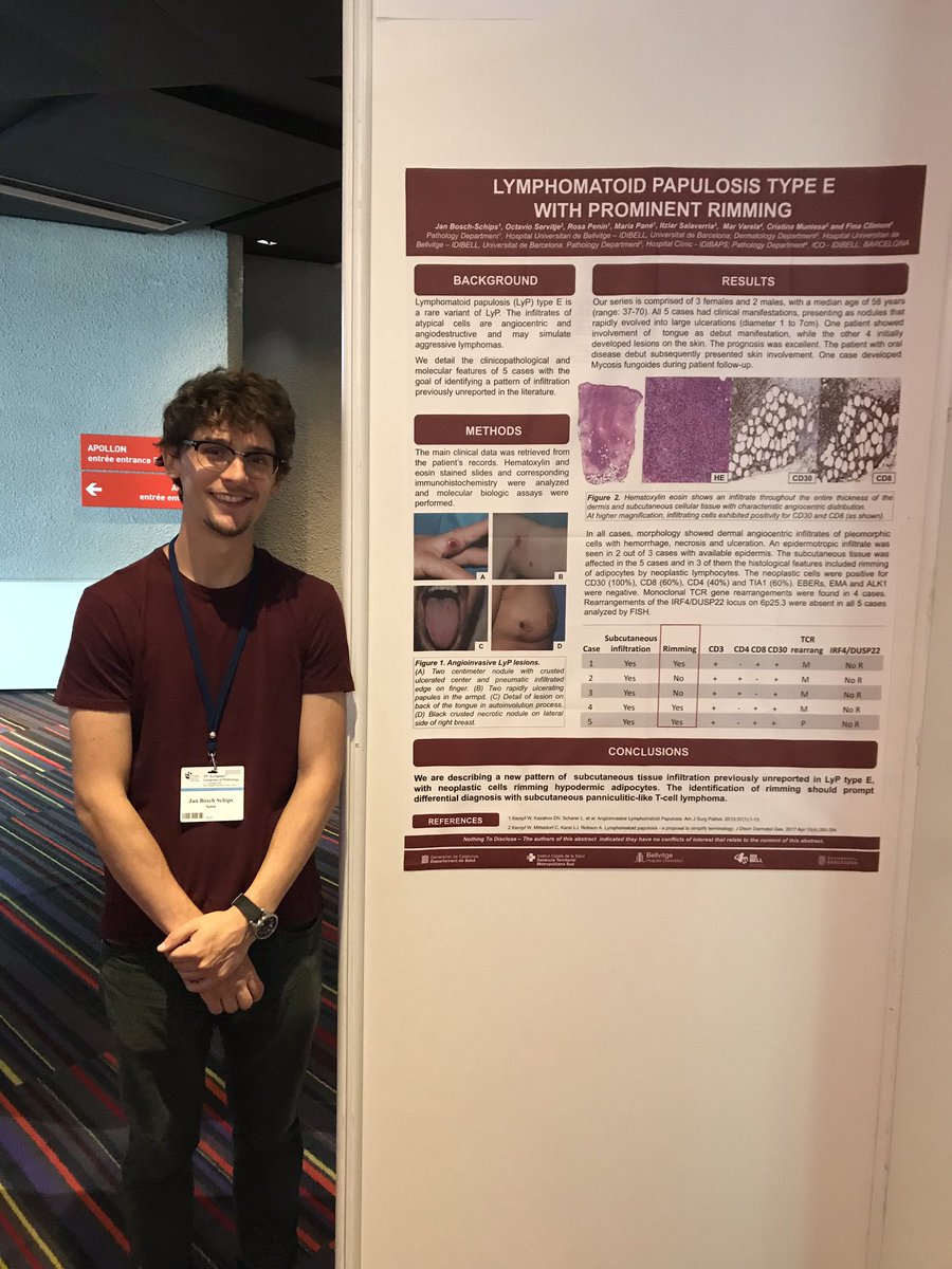 Our third year resident Jan (<a href="/Pathohead/">Jan Bosch-Schips</a>) presenting both his posters in #ECP2019Nice! We’re so proud! #breastpath #hemepath #ECPNice2019