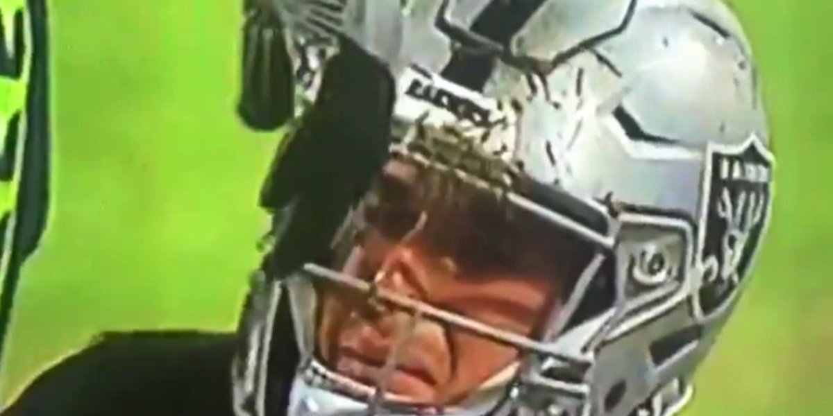 TiltedPigskin's tweet photo. @dipjellymiguel @DylanJoy7 @MyFantasyLeague I mean this https://t.co/TTGmisgi1d