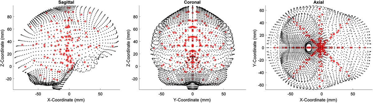 ABME (@abmejournal) on Twitter photo Computational technique used can greatly affect the results of finite element modeling of traumatic brain injury events <a href="/UVAEngineers/">UVA Engineering</a> <a href="/Neurotrauma/">NeurotraumaSociety</a> <a href="/BMESociety/">Biomedical Engineering Society</a> <a href="/SpringerNature/">Springer Nature</a>
Read more in our brain trauma modeling special issue
link.springer.com/article/10.100… Computational technique used can greatly affect the results of finite element modeling of traumatic brain injury events <a href="/UVAEngineers/">UVA Engineering</a> <a href="/Neurotrauma/">NeurotraumaSociety</a> <a href="/BMESociety/">Biomedical Engineering Society</a> <a href="/SpringerNature/">Springer Nature</a>
Read more in our brain trauma modeling special issue
link.springer.com/article/10.100…