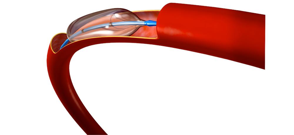 medtechonline's tweet photo. Heraeus finalises acquisition of medical device outsource partner: https://t.co/1y2ESDfixj #medtech #Haraeus #ViaBiomedical https://t.co/BSVQfFuSto