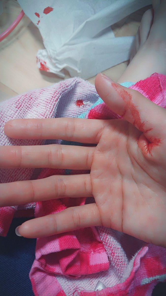 猫くん 一回失敗しちゃった ﾛ また刺し直してなんとかあいた 風呂入ったのに耳洗わなきゃだし 髪血で固まったから朝風呂入らなきゃだ