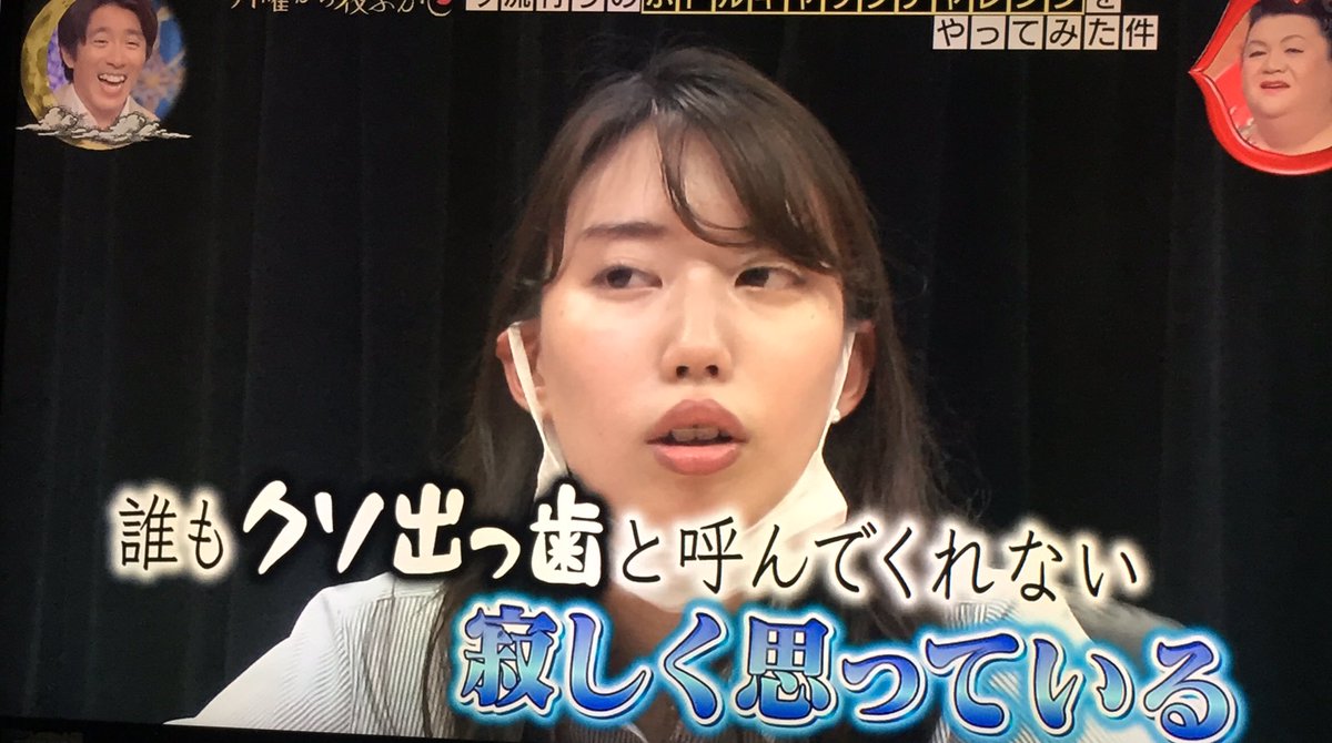 クソ出っ歯 クソ出っ歯