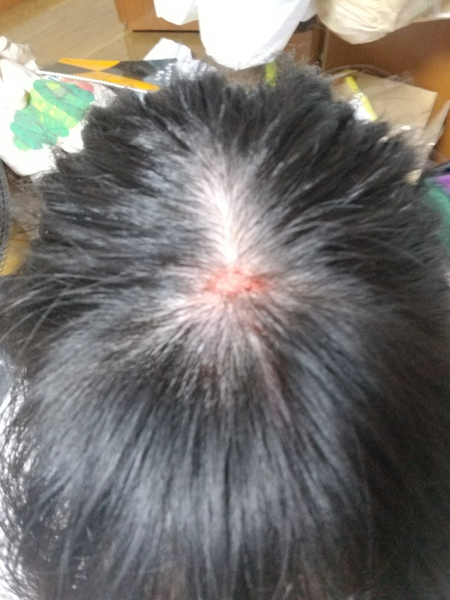 プラチナ 古傷組を推す者 頭から出血してる 地味にめんどくさい T Co 6sydkuhl9r Twitter