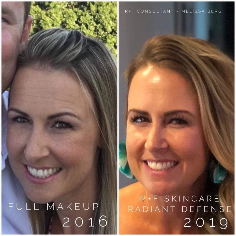 Rodan_Fields_rd's tweet photo. Skincare can make all the difference! ❣️Fall in love with your reflection!! https://t.co/ES6cwq3hTW