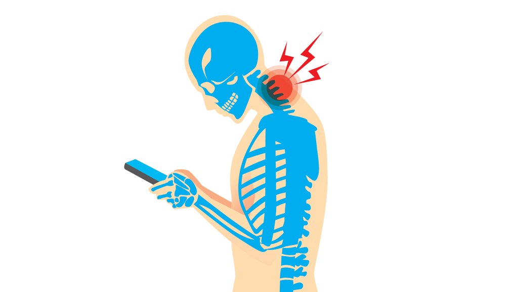 drtrinachiro's tweet photo. Text Neck – Do I Have It? https://t.co/EUB3rZhls9 https://t.co/ogAwuke00u