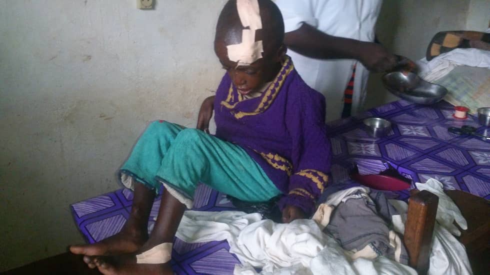 tata_charles's tweet photo. #EMMANUEL,HE WAS WITH HIS YOUNGER ONEWE'RE STILL TRYING TO SEE IF WE CAN FIND           We so him yesterday Sunday 8th september 2019, after church with wounds on his head and legs.#EMERGENCY(1). Food.                   (2).Clothes.(3).Shelter.              (5).Prayers.#LOVE4ALL https://t.co/uzPHmGbs4P