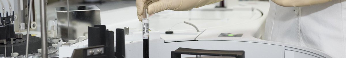 GBSLeiden.com's innovative and high-tech research labs can help you to generate accurate and reproducible data for your research.