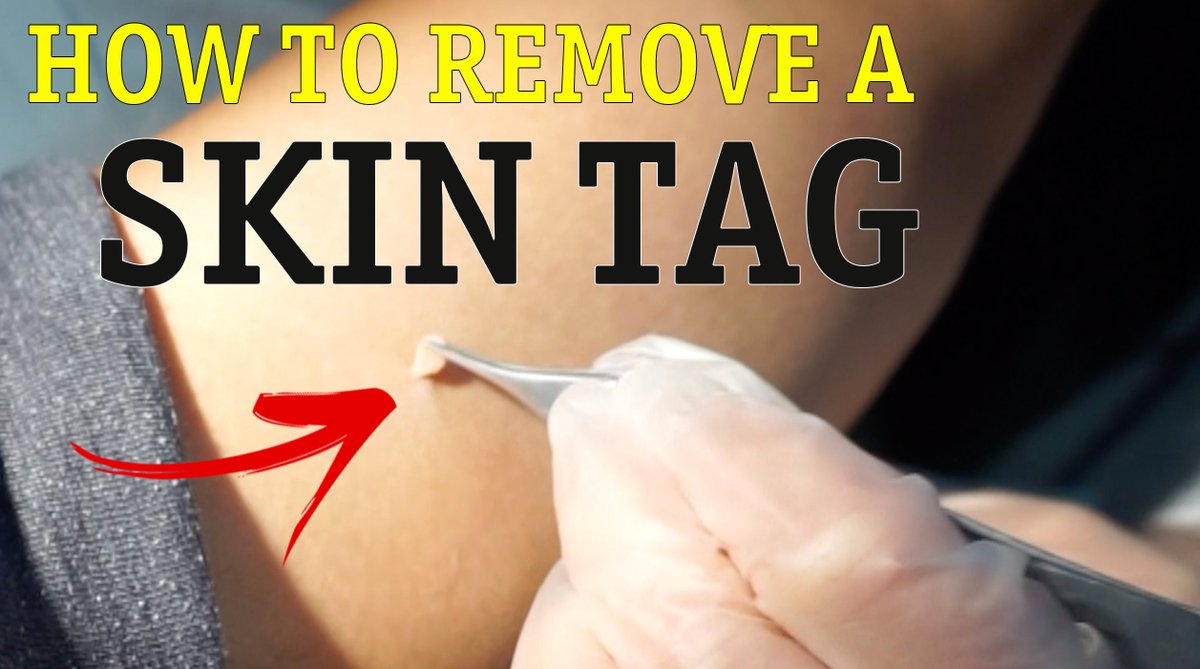 MakeEasyChannel's tweet photo. If you want to see it, this is how to do it safely! https://t.co/f0VCLy5ba4 #skintag https://t.co/w1KtTsbwe4