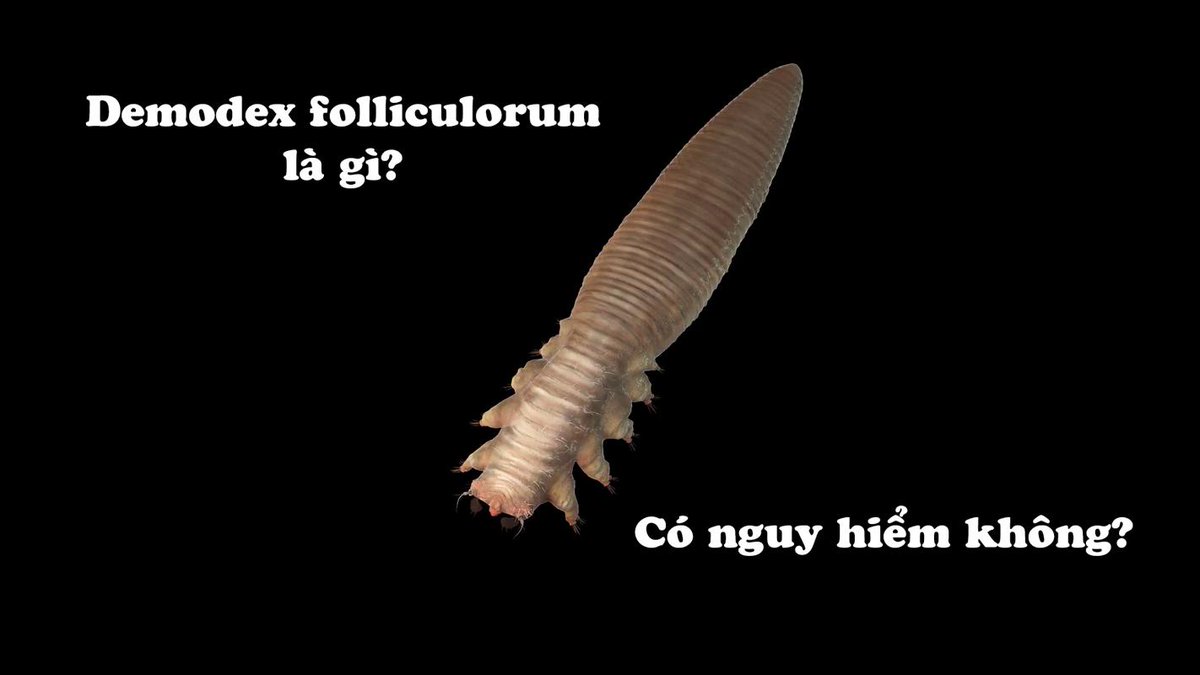 PhysiodermieVi1's tweet photo. Demodex là tên gọi của một loại ký sinh trùng (hay còn gọi là bọ ve) chúng là một trong số hàng tỷ ký sinh trùng hiện đang sống trên da của chúng ta. Xem thêm..
https://t.co/J3YRQOE7US https://t.co/PH9tmKtanR