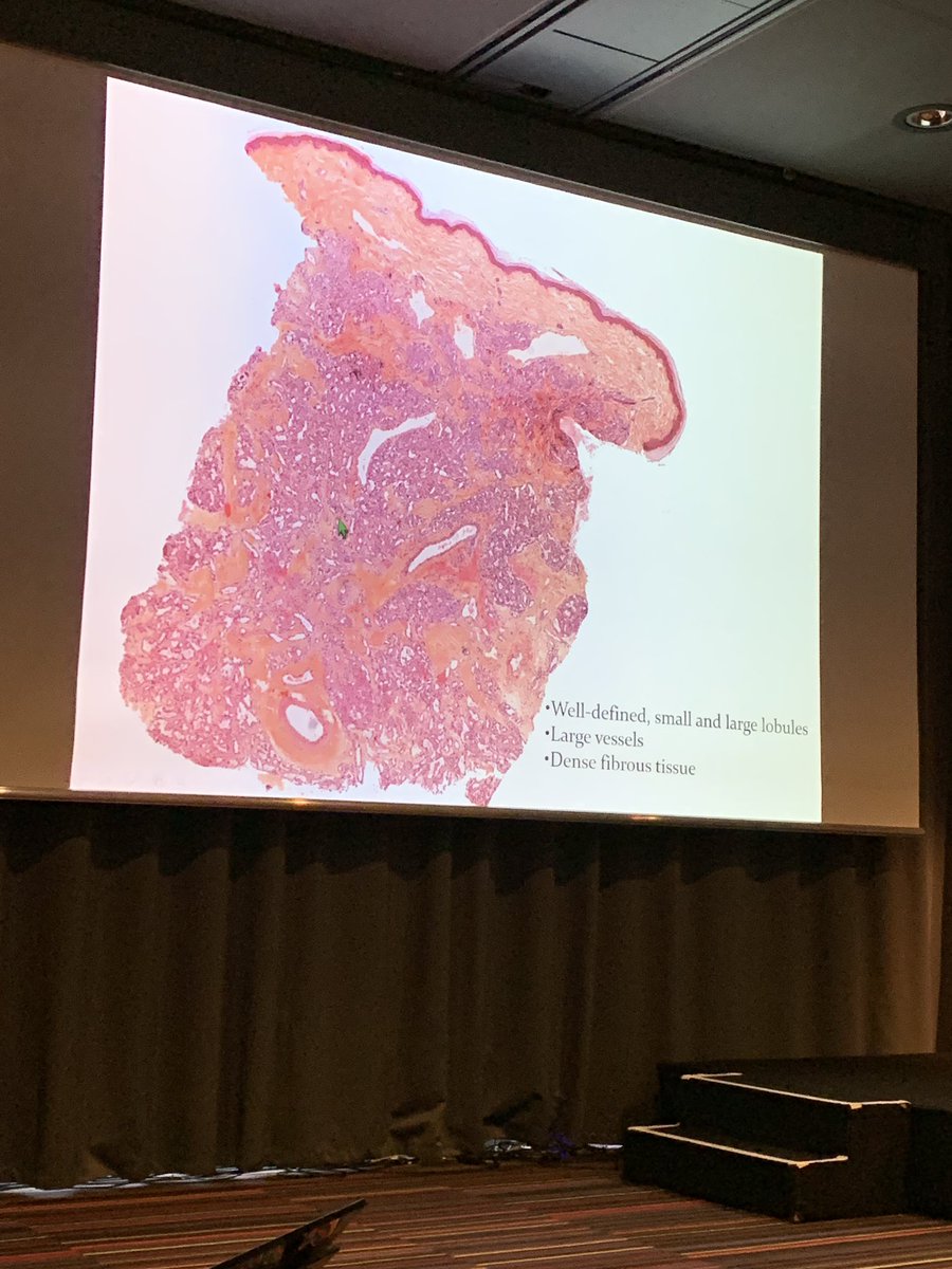 mreyesm's tweet photo. Excellent talk by Prof. Sylvie Fraitag at the #ECP2019Nice #PediPath session on vascular lesions. https://t.co/L0OJfbetwT