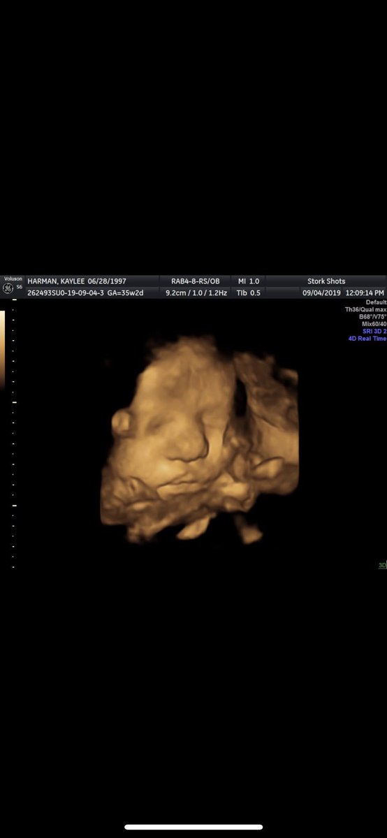 Harman060597's tweet image. I can’t wait for our baby boy to be here. I love you @HarmanKaylee19 and all that you’ve endured for us to be able to start a family.