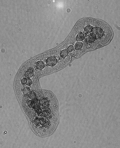 MargaretBrisbin's tweet photo. I found this collodarian while sorting plankton this week! Im always excited to find these because they have such great shapes, but also because I expected to see more of them. Happy #TinyPrettyTuesday :) #protists #plankton #radiolaria https://t.co/Q97NIM2eL8