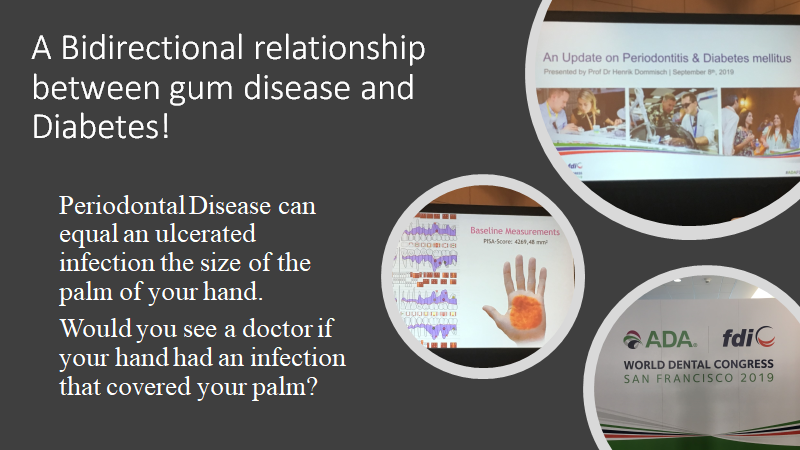ghackdds's tweet photo. Thank you Dr. Dommisch for your great lecture at #ADAFDI on the Bidirectional relationship between #Periodontitis and #Diabetes. With over 50% of the US adult population now having diabetes or prediabetes, #Dentists need to help mitigate this epidemic. @ADANews @fdiworlddental https://t.co/swSu60p4S4