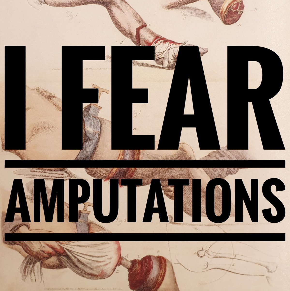 OldOpTheatre's tweet photo. Our #medicalfears today are at the heart of our museum as many visitors have expressed a deep fear of undergoing an amputation.
You can share your fears with us in the comments, or using #MedicalFears or by visiting the Old Operating Theatre in person. #histmed #oldoptheatre https://t.co/ypENZgkyUe