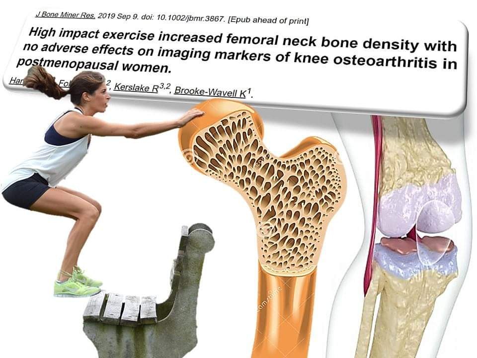 felipeisidro13's tweet photo. Ejercicios de ALTO IMPACTO  mejoran la DENSIDAD MINERAL ÓSEA del cuello femoral (sin efectos negativos en los biomarcadores de imágenes de artrosis de rodilla) reduciendo riesgo de fractura de cadera en mujeres posmenopáusicas.
https://t.co/d62yY9RIM2 https://t.co/iU2hzYp8cR