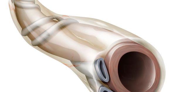 lipwnis's tweet photo. FDA Warning About Stemell's Use Of Umbilical Cords https://t.co/pkEogGUbc5 https://t.co/JuGFn2tgCk