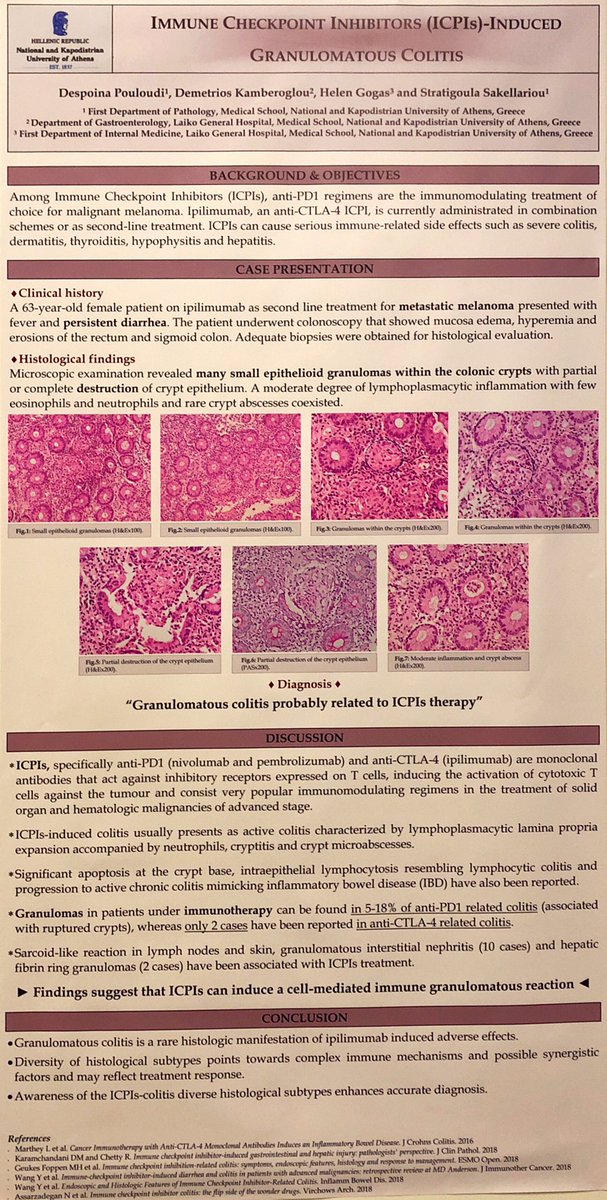 CamilleB_path's tweet photo. Some great posters In #ECP2019Nice today
#PathologyisNice
#GIPath https://t.co/qR4Q5WWVxX