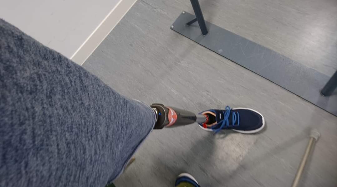 Hopalonglloydy's tweet image. I&apos;ve had my @ottobockuk #CLeg4 exactly a year today. What an amazing bit of kit it is. I didn&apos;t ever think Id walk &quot;normally&quot; or be able to hold hands with my wife or kids whilst out. Let alone walk 10k with it. 😍 
#ThankYou #CLegExperience #TheresNoDisInAbility #Day365WithACLeg
