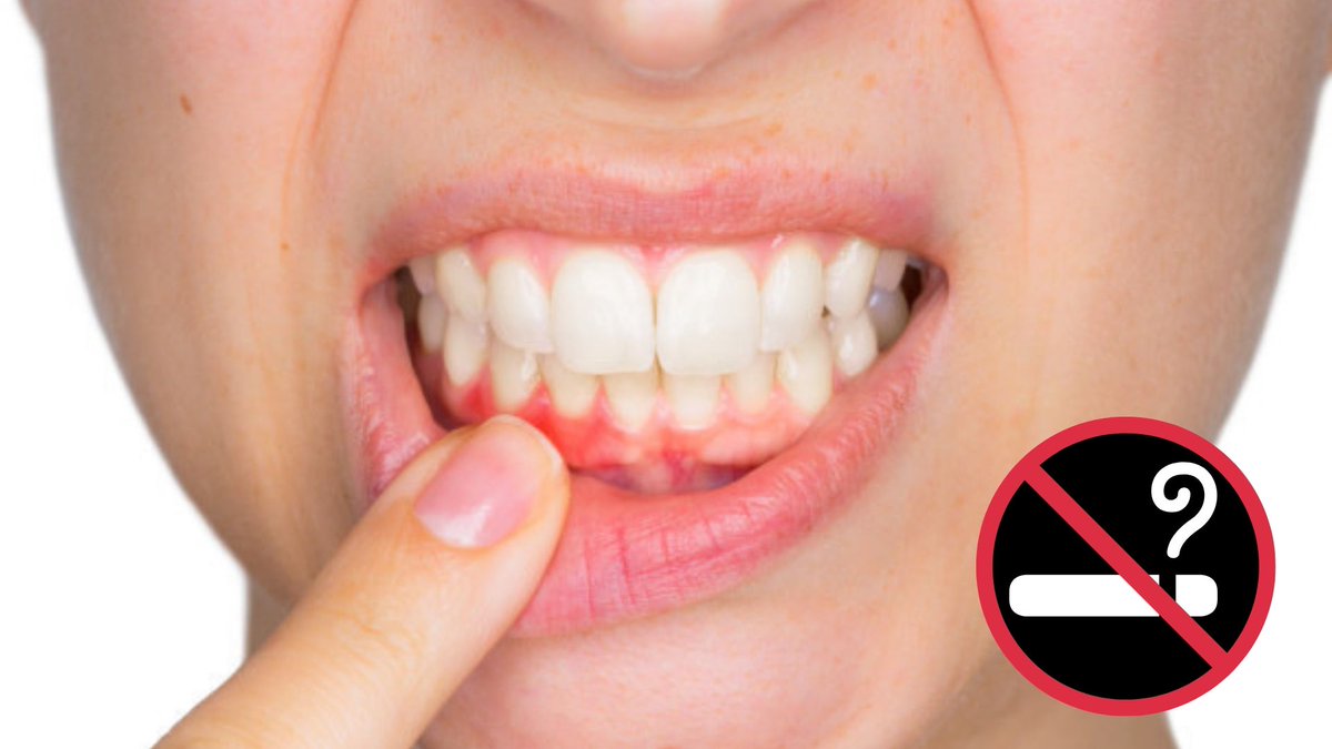 Four Facts About Vaping: Vape Clouds are not water vapour! Nicotine DOES  have health impacts. Vaping increases the risks of halitosis and gum disease.  Vaping decreases the expression of 358 genes related