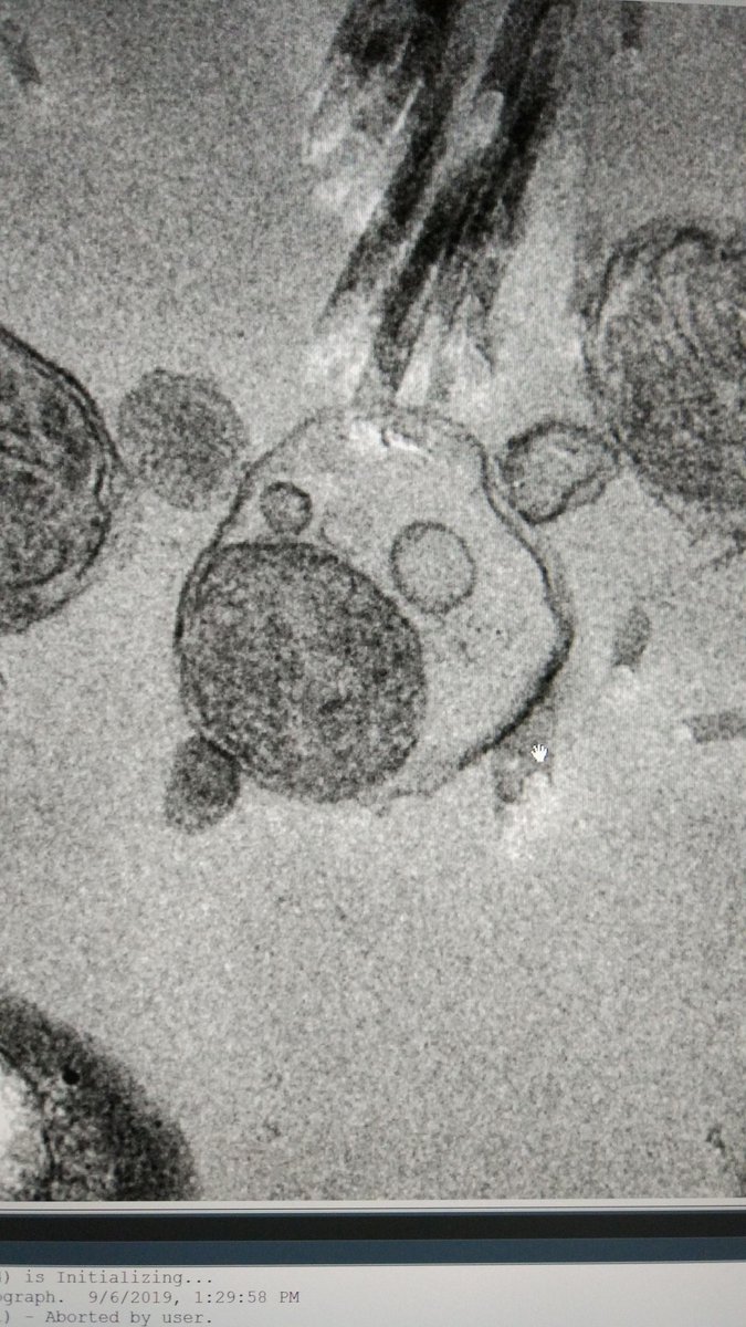 strucbiowarwick's tweet photo. A cartoon pig from a pig sample. @friendlymicrobe @DrMarwa_Hassan https://t.co/P3C0hrppWs
