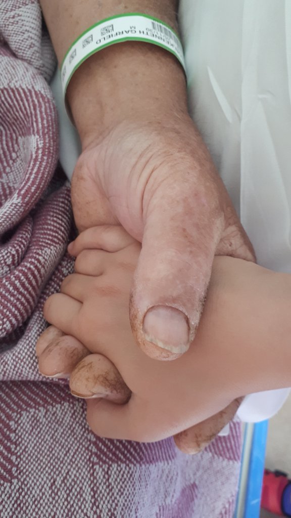 birthlyTO's tweet photo. My father-in-law was very ill this summer and in the hospital. This is one way to offer #empathy. Being present with someone when they are suffering.  Just showing up.
Have you ever received this kind of empathy? Tell me how it felt in one word

#hypnobirthing #evidencebasedbirth https://t.co/xLi8MZImME