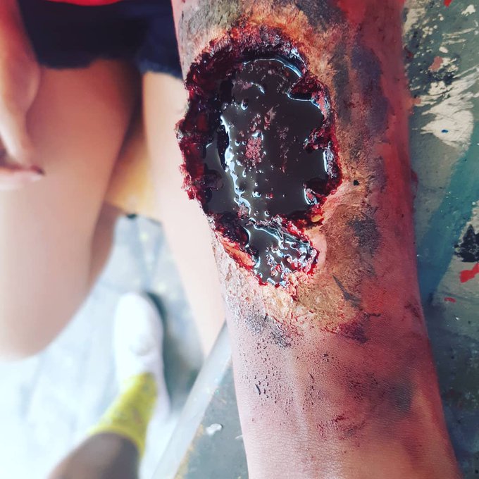 Ouch #damn #ouch #followme https://t.co/HPCUbkyDi7<a href="/tag/damn"class="tags">#damn</a><a href="/tag/ouch"class="tags">#ouch</a><a href="/tag/followme"class="tags">#followme</a>