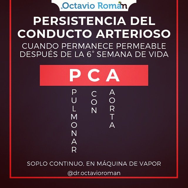 droctavioroman's tweet photo. Es la cardiopatía congénita más frecuente en México.
#repaso #repasoenarm #enarm  #enarm2019 #repasomédico #medstudent #médico #octavioroman  #GPC #persistenciadelconductoarterioso #PCA #cardiología #pediatría #soplo #disnea #vascular #cardiopatiacongenita #cardiopatia https://t.co/yXtY9Wr0so
