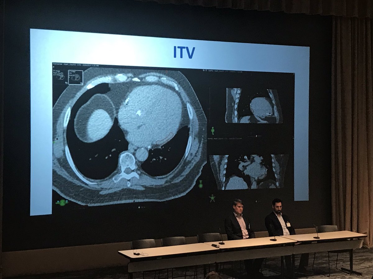 DanielAlyeshmer's tweet image. Pearl from #SNORAD2019, when building your program, imaging is central. #RadOncs view imaging sagittal/coronal/axial in relation to whole body while #EPeeps prefer RAO/LAO in relation to axis of heart. You’ll need to develop common terminology &amp;amp; thinking in 17 segments is helpful