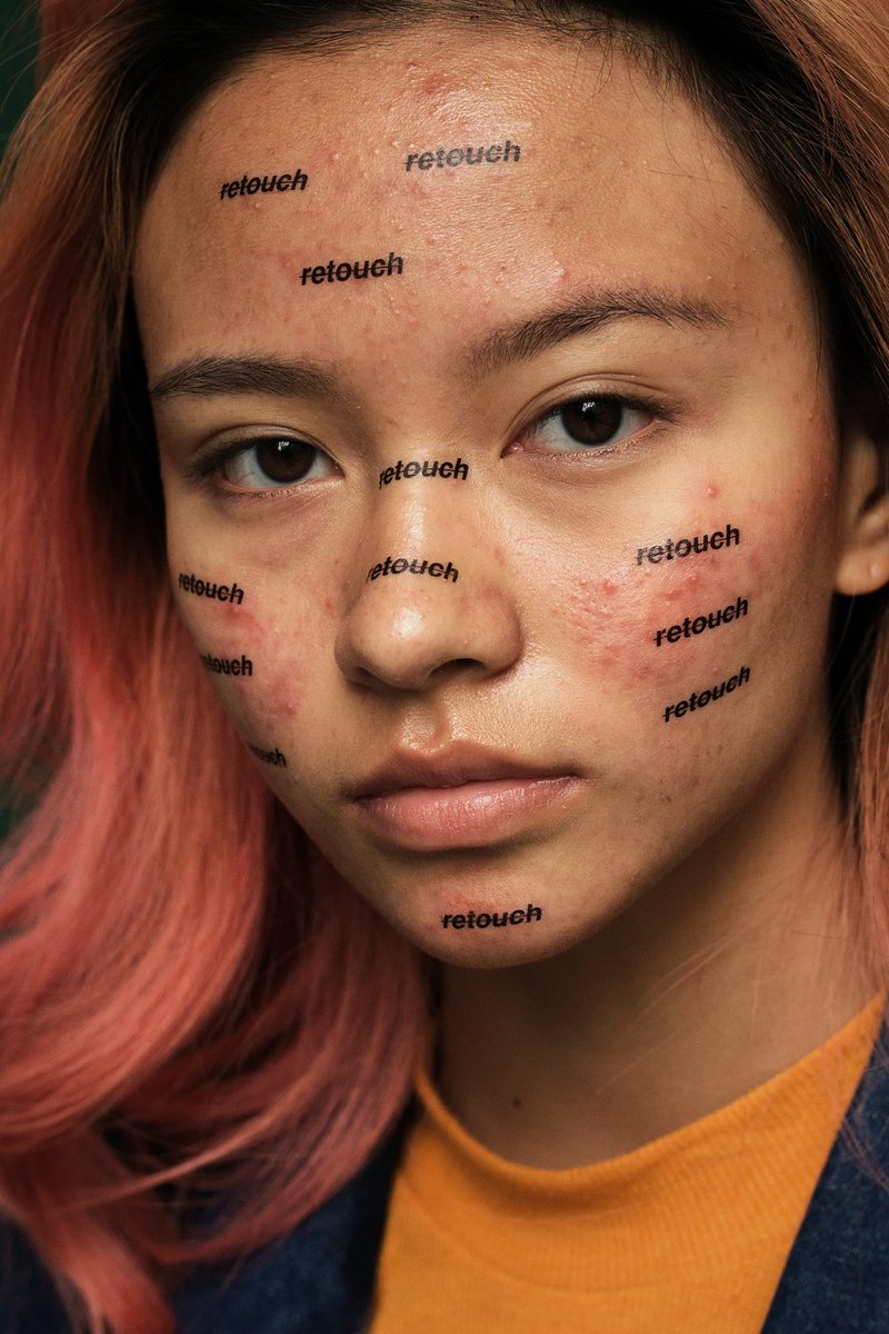 VICE_ID's tweet photo. Jerawat Kini Tak Lagi Haram Dalam Fotografi Fesyen: https://t.co/ng6bjoDXvm https://t.co/SjSjPgPVy1