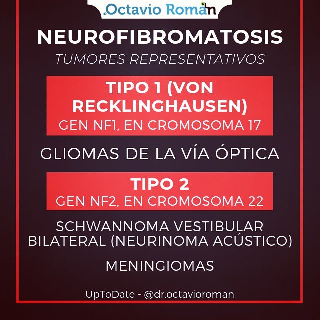 droctavioroman's tweet photo. En los pacientes con NF pueden aparecer diversos tumores, para un caso clínico ENARM es importante recordar por lo menos estas asociaciones.
#repaso #repasoenarm #enarm  #enarm2019 #meningioma #schwannoma #octavioroman https://t.co/ZpTM05a2yX