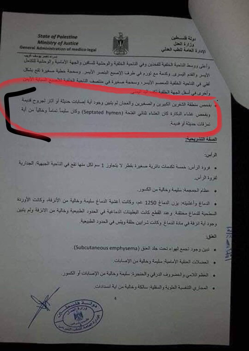 AlyaAwada's tweet photo. مع رفضي التام لورود هكذا معلومات في تقرير للطب الشرعي وفي قضية قتل أو في أي مكان، لان أجساد النساء تخصهن وحدهنّ ....ولكن.."غشاء بكارتكم" يللي قتلتوا #اسراء_غريب من اجله. قتلتوها من اجل شرف لم تطلبه منكم يومًا....تقرير الطبيب الشرعي يؤكد أنه كان سليمًا! 
#العداله_لاسراء_غريب https://t.co/KBIr2d85xv