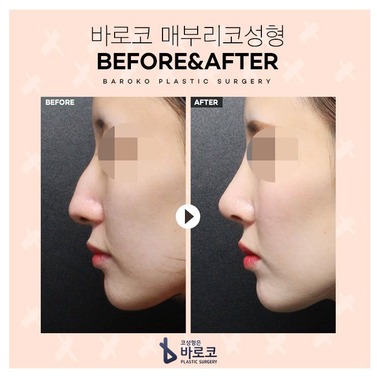 ワシ鼻 Twitter Search Twitter